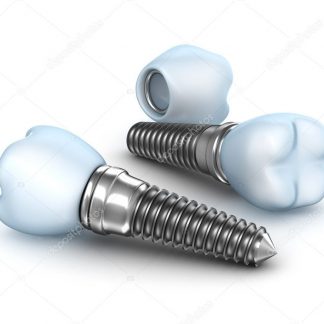 Implant dentaire